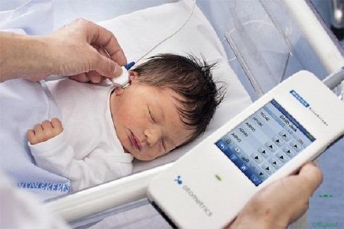 Khi nào cần đo thính lực cho trẻ?