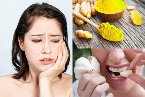 8 cách giảm đau tại nhà khi mọc răng khôn