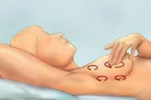 Một người mắc bệnh ung thư sẽ thấy 2 dấu vết kỳ lạ ở ngực, càng khám sớm thì cơ hội điều trị, sống sót càng cao