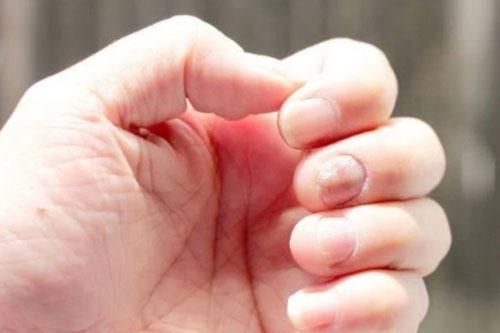 5 triệu chứng lặp đi lặp lại chứng tỏ gan đang tích tụ quá nhiều độc tố