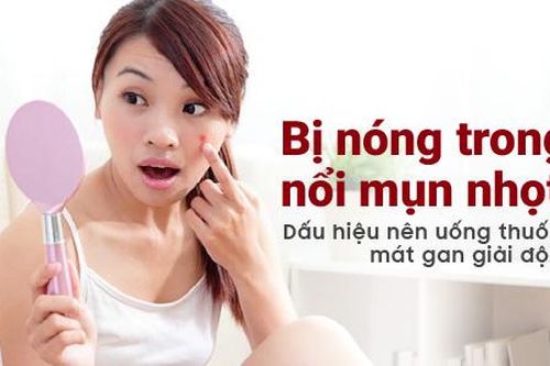 Nóng trong, nổi mụn - dấu hiệu cần uống thuốc mát gan giải độc