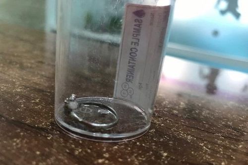 Bé 3 tuổi nuốt nhẫn bạc vào dạ dày