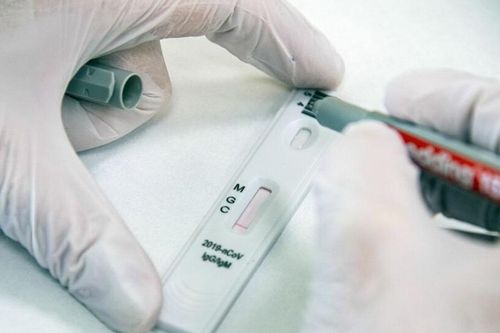 Nga phát triển dụng cụ đo kháng thể đối với virus SARS-CoV-2 tại nhà