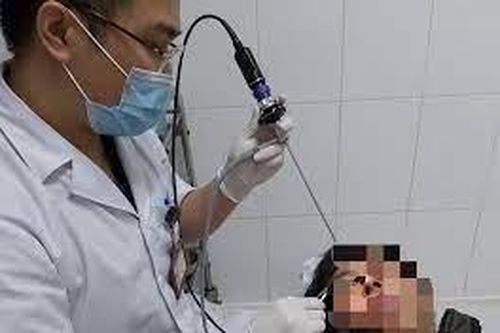 Rùng mình con đỉa dài 5cm trong mũi người đàn ông 50 tuổi