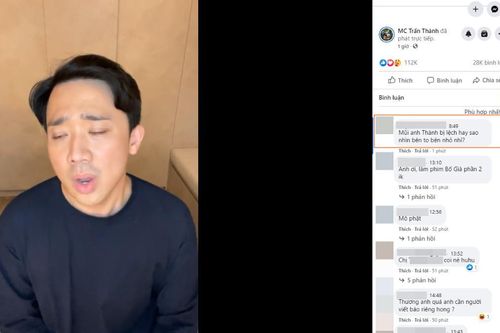 Cư dân mạng xôn xao bình luận vì chiếc mũi lạ của Trấn Thành