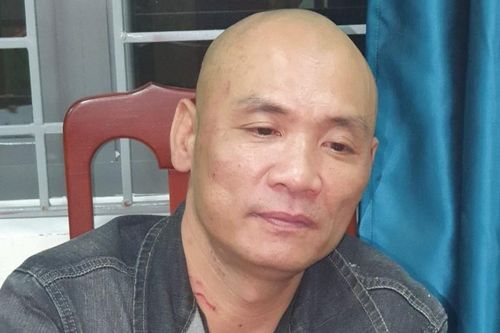 Đại úy cảnh sát gãy ngón tay khi khống chế kẻ côn đồ