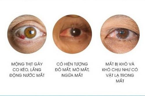 Chữa trị mộng thịt ở mắt