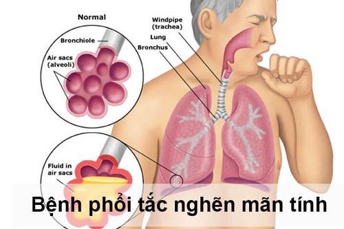 Chế độ ăn cho người bệnh phổi tắc nghẽn mạn tính