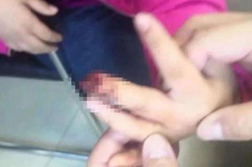 Cha mẹ chủ quan dễ khiến trẻ mất chức năng cầm nắm