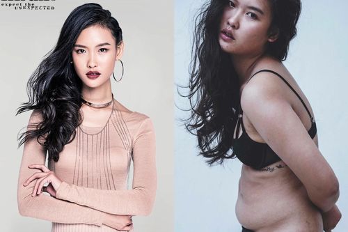 Nữ người mẫu tăng 17 kg