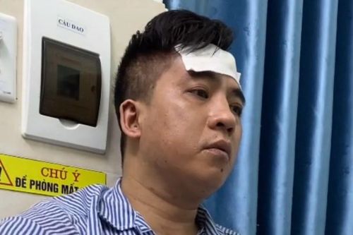 Bắt kẻ sát hại người phụ nữ trong nhà nghỉ