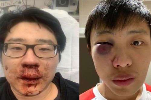 Người gốc Á đang là nạn nhân của thù ghét trên khắp thế giới