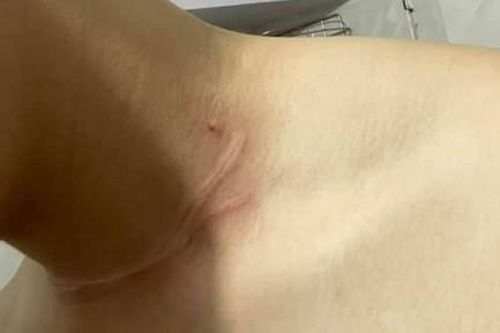 Nhiều người lưu thông trên đường ở Sài Gòn bị dây diều cuốn cổ