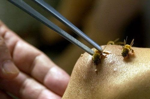Đang đi ngoài đường, cụ ông 80 tuổi ở Phú Thọ bị bầy ong vò vẽ đốt nguy kịch