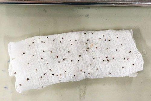 Bị hơn 100 con ong vò vẽ đốt, cụ ông 80 tuổi nguy kịch