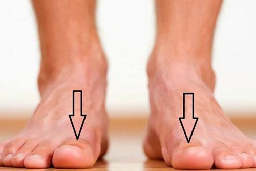 Bàn chân xuất hiện dấu hiệu này, cảnh báo thận đang ngày một suy kiệt, hãy điều trị sớm