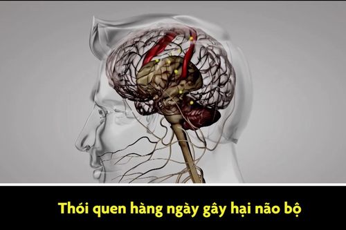 Thói quen hàng ngày gây hại não bộ mà bạn không biết