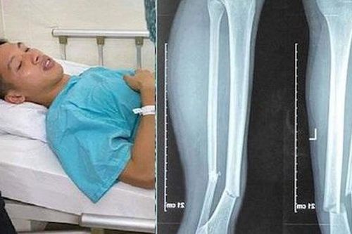 Chuyên gia nói gì về chấn thương của cầu thủ Đỗ Hùng Dũng?
