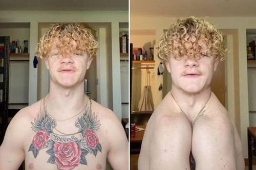 Cực dị chàng trai không có xương quai xanh, có thể vỗ tay bằng vai