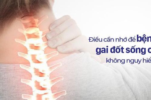 Những điều cần ghi nhớ để bệnh gai đốt sống cổ không gây nguy hiểm