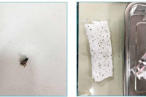 Cấp cứu thành công cụ ông 80 tuổi bị hơn 100 con ong vò vẽ đốt
