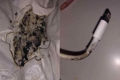 Thiếu nữ bỏng mặt do sạc iPhone phát nổ