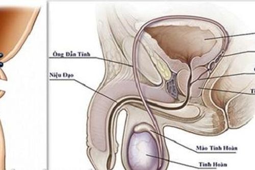 Thắt ống dẫn tinh - Biện pháp tránh thai hiệu quả, ít rủi ro