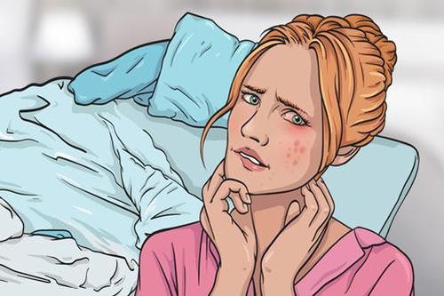 Điều gì có thể xảy ra với sức khỏe nếu không thường xuyên giặt ga gối?