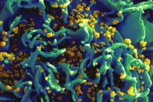 Sắp thử nghiệm lâm sàng vaccine ngừa HIV