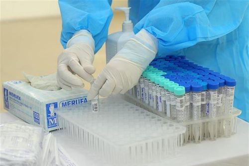 Hà Nội xét nghiệm virus SARS-CoV-2 cho hơn 4.000 người