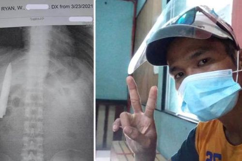 Đau tức ngực, người đàn ông choáng váng khi phát hiện lưỡi dao 10cm găm bên trong