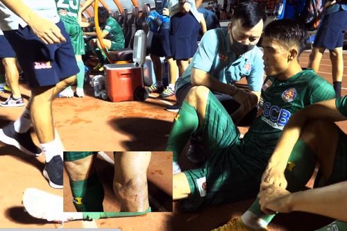 Án phạt vụ Hùng Dũng gãy chân chưa ráo mực, cựu hậu ĐTVN đã bị đối thủ đạp thô bạo!