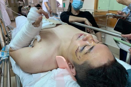 Hai người rơi do sập trần chung cư: Nạn nhân bị gãy xương cột sống