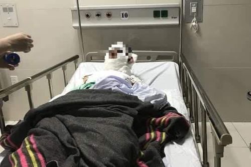 Cháy thùng xăng trên tàu cá, ba người bị bỏng