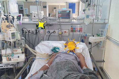 Sốc: Ngộ độc vì ăn cua mặt quỷ, bệnh nhân ngừng tim, hôn mê sâu