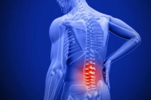 Thoái hóa cột sống là gì? Nguyên nhân, triệu chứng và cách khắc phục