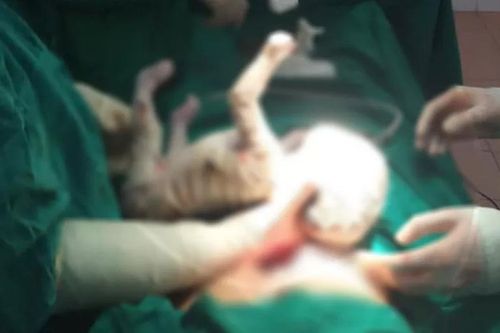 Bé sơ sinh mắc hội chứng da vảy cá ngay khi vừa chào đời