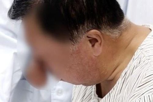 Căn bệnh khiến người mắc mọc mũi vòi voi sau khi uống rượu