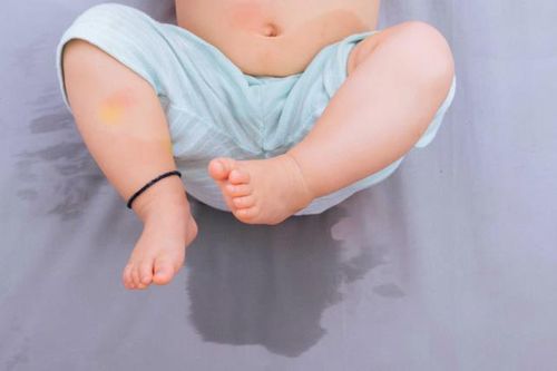 Dị tật khiến tinh hoàn bé trai thay đổi hình dạng đột ngột