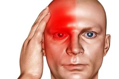 7 dấu hiệu nguy hiểm từ những cơn đau đầu bất thường và cách giải quyết