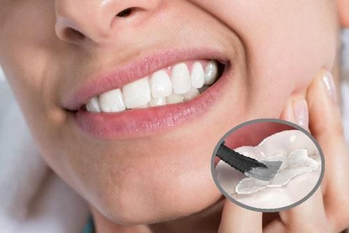 Thấy răng ê buốt thì chớ coi thường vì đó là dấu hiệu cảnh báo bạn đang có thói quen vô cùng nguy hại