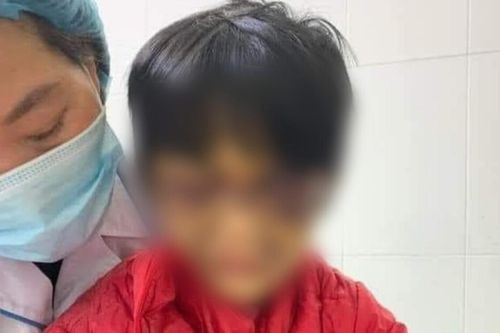 Khởi tố người mẹ nhốt con gái 6 tuổi vào phòng, đánh đập dã man vì con thường xuyên đi vệ sinh không bảo