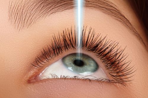 Nguyên nhân tái cận sau mổ mắt