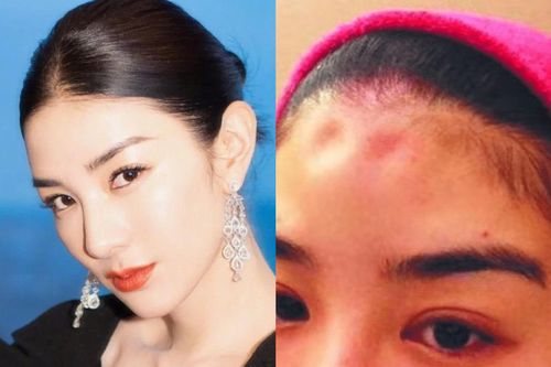 Huỳnh Dịch tố bị chồng cũ bạo hành khi mang bầu
