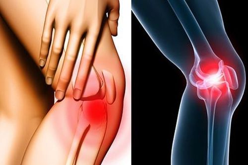Chấn thương thể thao - những điều cần biết