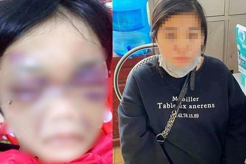 Tin mới vụ bé gái 6 tuổi ở Hải Dương bị mẹ đẻ bạo hành dã man