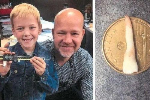 Chiếc răng sữa dài 2,5cm đi vào sách kỷ lục Guiness