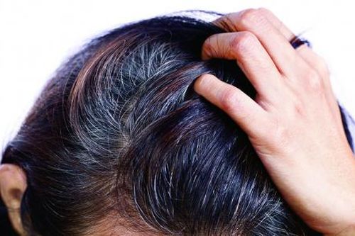 Sản phẩm chữa tóc bạc sớm, rụng tóc: Chỉ là quảng cáo 'lố' tính năng