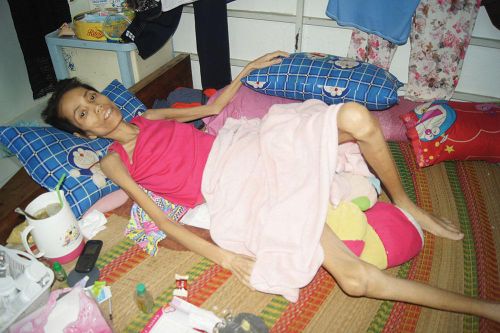 Người phụ nữ mắc bệnh ung thư cần được chia sẻ