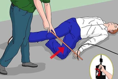 Nhiều tai nạn điện giật do câu cá, hướng dẫn sơ cứu khi bị bỏng điện